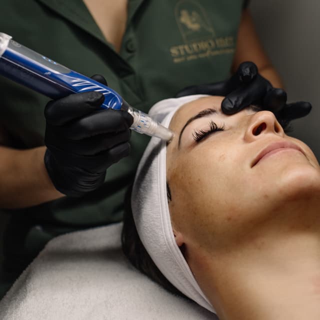 SkinPen® Microneedling+Exsosomes at Studio Eleven Eleven Day Spa & Boutique in Sebastian, FL