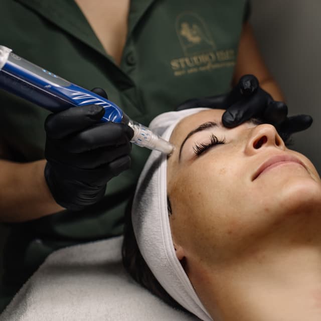 SkinPen® Microneedling at Studio Eleven Eleven Day Spa & Boutique in Sebastian, FL